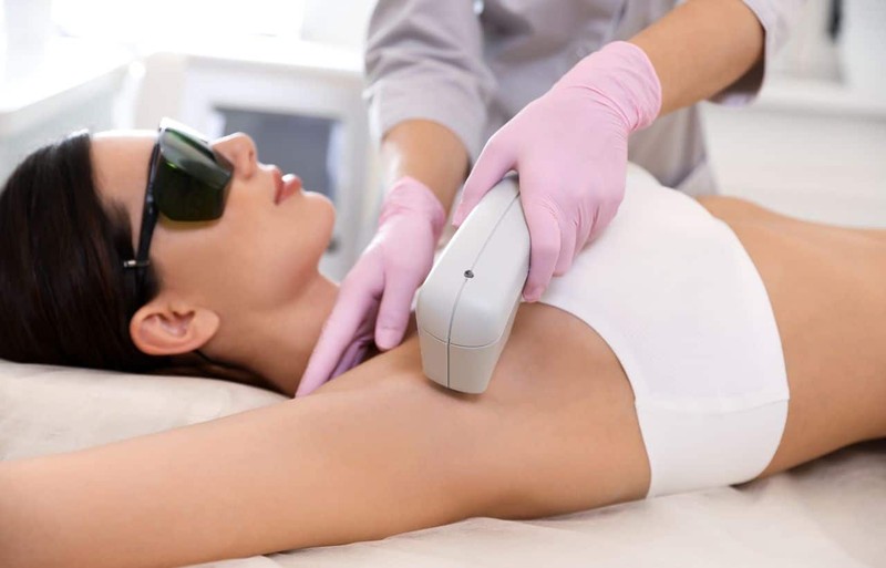 Depilación Láser en Axilas