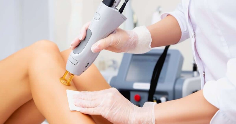 Depilación Láser en Piernas